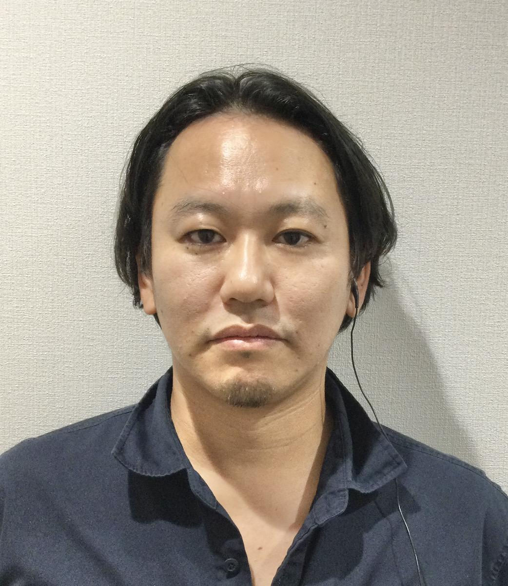 ヒアルロン酸施術後